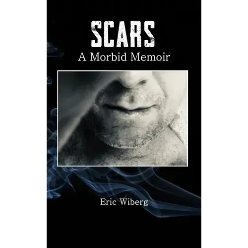 Scars: A Morbid Memoir