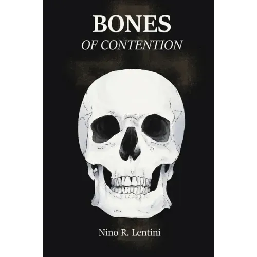 Bones of Contention