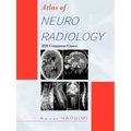 Atlas of Neuroradiology: 200 Common Cases