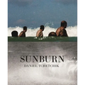 Sunburn