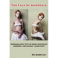 The Face of Anorexia