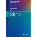 Scleritis