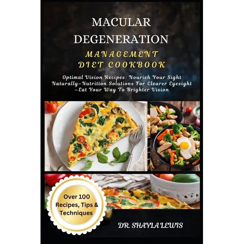 Macular Degeneration Management Diet Cookbook: Optimal Vision Recipes: Nourish Your Sight Naturally-Nutrition Solutions For Clearer Eyesight -Eat Your