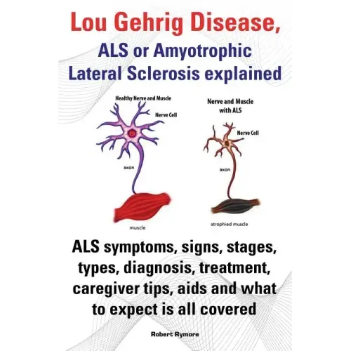 Lou Gehrig Disease, ALS or Amyotrophic Lateral Sclerosis Explained. ALS Symptoms, Signs, Stages, Types, Diagnosis, Treatment, Caregiver Tips, AIDS and