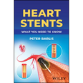 Heart Stents: What You Need to Know