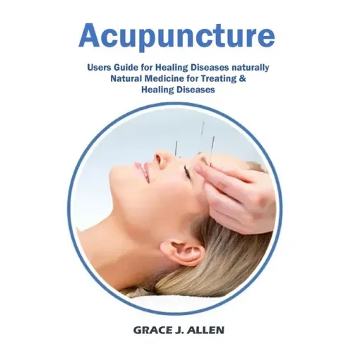 Acupuncture: Users Guide for Healing Diseases naturally Natural Medicine for Treating & Healing Diseases