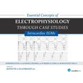 Essential Concepts of Electrophysiology Through Case Studies: Intracardiac EGMs: Intracardiac EGMs
