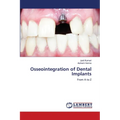 Osseointegration of Dental Implants