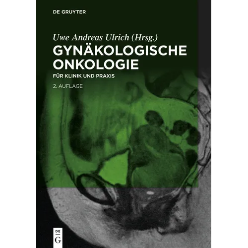 Gynäkologische Onkologie: Für Klinik Und PRAXIS