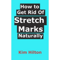 How to Get Rid Of Stretch Marks Naturally
