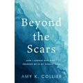 Beyond the Scars: How I Learned God Didn't Abandoned Me in My Darkest Hour