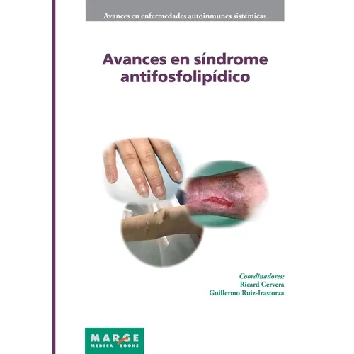 Avances en síndrome antifosfolipídico