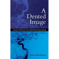 A Dented Image: Journeys of Recovery from Subarachnoid Haemorrhage
