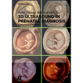 3D Ultrasound in Prenatal Diagnosis: A Practical Approach