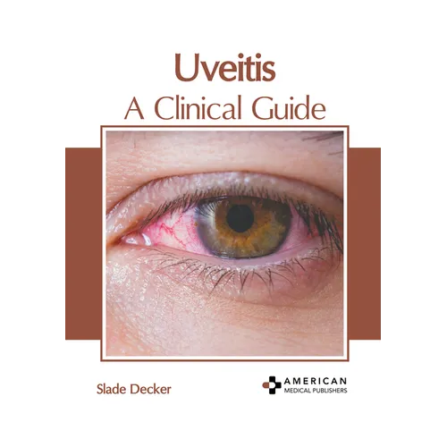 Uveitis: A Clinical Guide