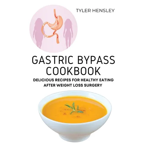 Gastric Bypass Cookbook: Delicious Recipes for Healthy Eating After Weight Loss Surgery