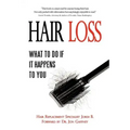 Hair Loss: What to do if it Happens to You