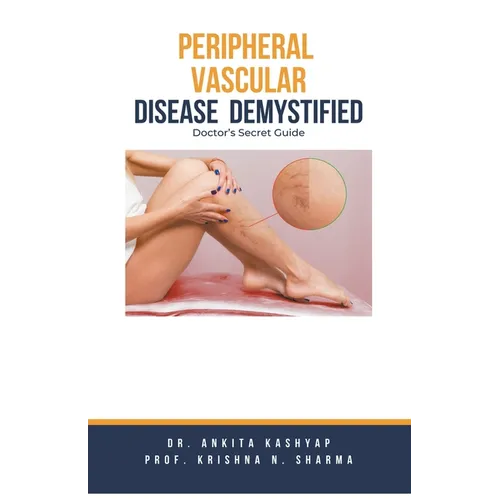 Peripheral Vascular Disease Demystified: Doctor's Secret Guide