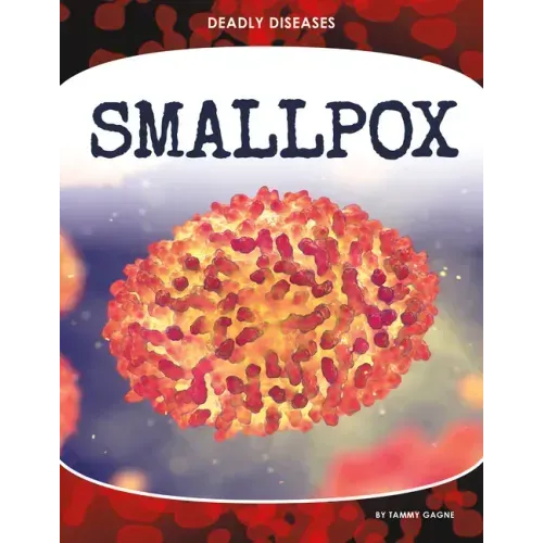 Smallpox