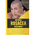 Natural Rosacea Treatment: How to Reduce Inflammation in the Skin, Balance the body and Control Face and Scalp Seborrheic Dermatitis, Dandruff an