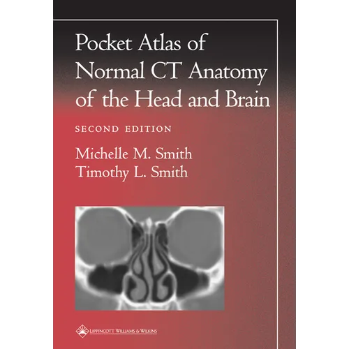 Pocket Atlas of Normal CT Anatomy of the Head and Brain