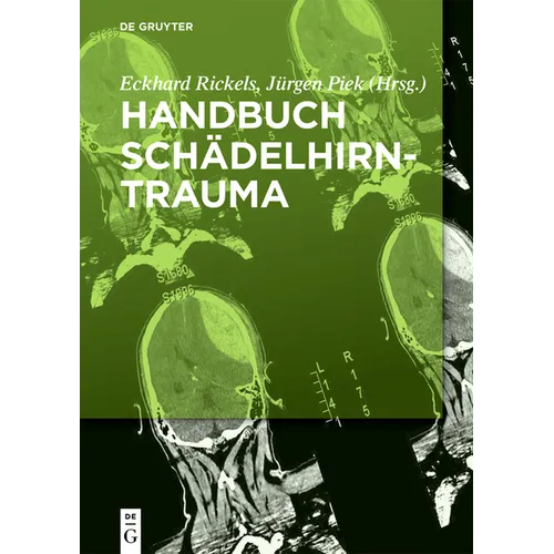 Handbuch Schädelhirntrauma