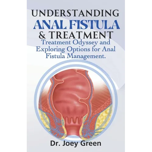 Understanding Anal Fistula & Treatment: Treatment Odyssey and Exploring Options for Anal Fistula Management.