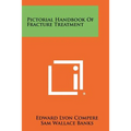 Pictorial Handbook Of Fracture Treatment