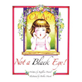 Oh No! Not a Black Eye!