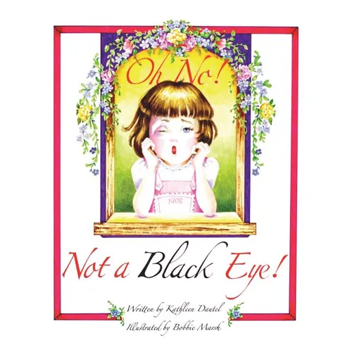 Oh No! Not a Black Eye!
