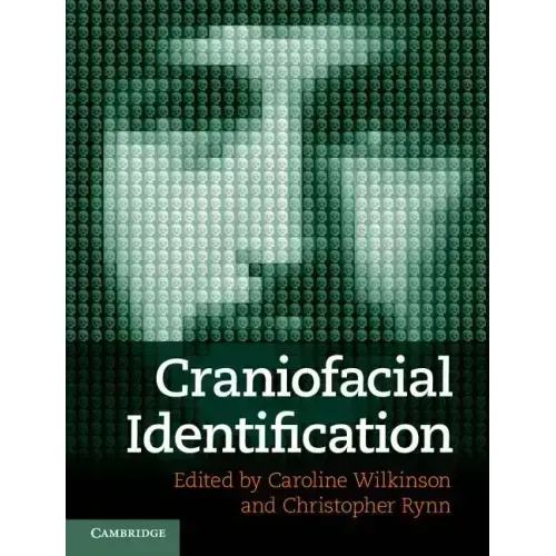 Craniofacial Identification