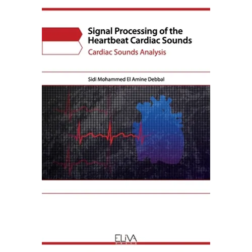 Signal Processing of the Heartbeat Cardiac Sounds: Cardiac Sounds Analysis