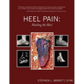 Heel Pain: Healing the Heel
