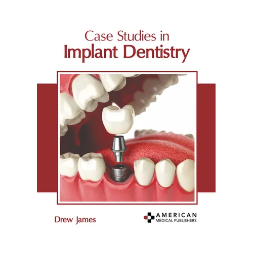 Case Studies in Implant Dentistry