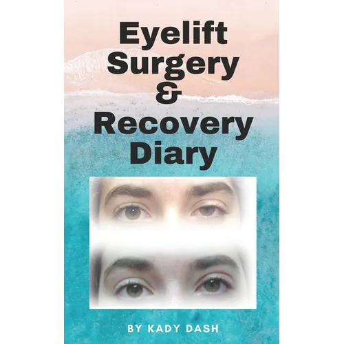 Eyelift Surgery and Recovery Diary: Ptosis, eyelifts, punctal plugs, and dry eyes