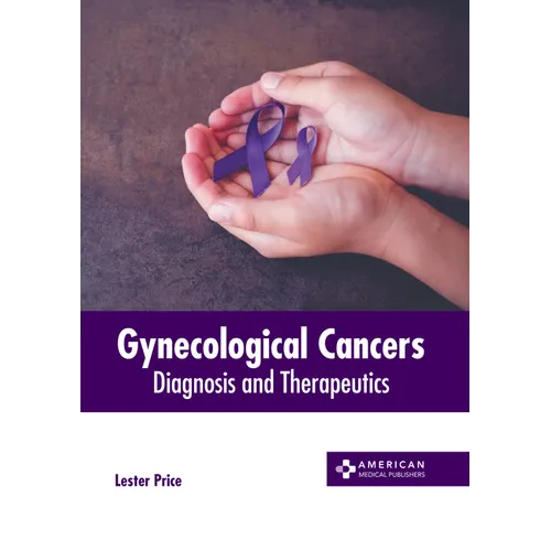 Gynecological Cancers: Diagnosis and Therapeutics
