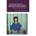 Enfermera Florence(R), ¿Qué es una Lesión Cerebral Traumática? (Latinoamérica)