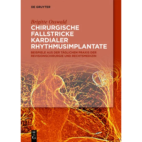 Chirurgische Fallstricke Kardialer Rhythmusimplantate: Beispiele Aus Der Täglichen PRAXIS Der Revisionschirurgie Und Rechtsmedizin