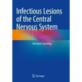 Infectious Lesions of the Central Nervous System