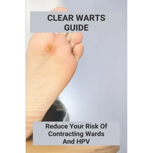Clear Warts Guide: Reduce Your Risk Of Contracting Wards And Hpv: Does Duct Tape Get Rid Of Warts