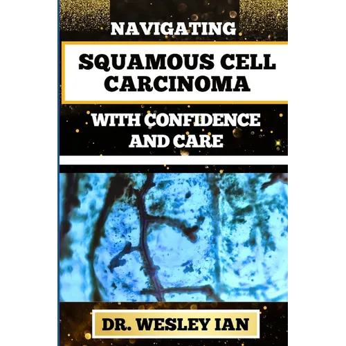 Navigating Squamous Cell Carcinoma with Confidence and Care: Empowering Strategies And Finding Strength For Confronting Cell Cancer For Holistic Recov