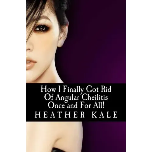 How I Finally Got Rid Of Angular Cheilitis Once and For All!: Cracked Mouth Corners No More