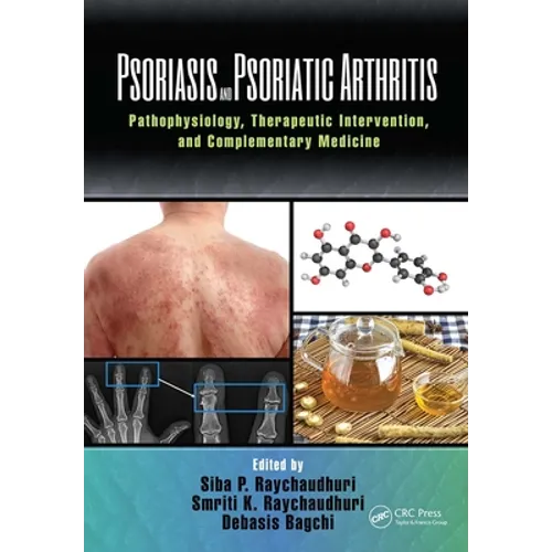 Psoriasis and Psoriatic Arthritis: Pathophysiology, Therapeutic Intervention, and Complementary Medicine