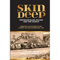 Skin Deep: Pentecostalism, Racism and the Church: