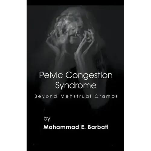 Pelvic Congestion Syndrome - Beyond Menstrual Cramps