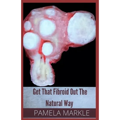 Get That Fibroid Out the Natural Way