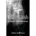 Life is Greater Than Limb: My Journey to Becoming Whole