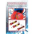 Manual de Procedimientos Cardiacos Intervencionistas Para Cardiólogos Principiantes: (un Resumen de la Literatura Actual Sobre Cardiología)