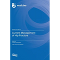 Current Management of Hip Fracture