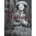 Face of Madness: Hugh W. Diamond and the Origin of Psychiatric Photography